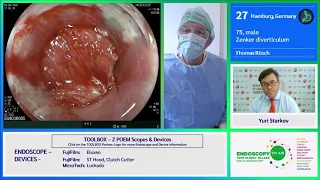 EOA 2020 Case 22 Zenker diverticulum   Rösch mpg