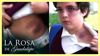 Nico y los niños muestran sus golpes de agresiones | 3/3 | Sin miedo en el corazón