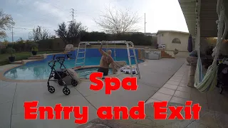 Spa Entry and Exit with Bilateral Total Knee Replacement Mikey Mike TKR Quick Recovery Pain Surgery