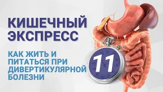 №11 КИШЕЧНЫЙ ЭКСПРЕСС. Как жить и питаться при дивертикулярной болезни