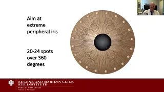 Lecture: Glaucoma Surgery: An Evolving Art and Science