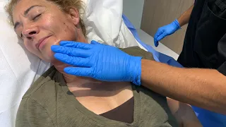 ACCELERATE HEALING OF NECK LIPO AND PLASTIC SURGERY WITH THIS LYMPHATIC MASSAGE |Dr. Jason Emer