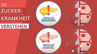 Was ist Diabetes Typ 2? | Stiftung Gesundheitswissen