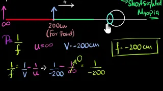 Numerical on myopia