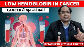 Low hemoglobin in cancer causes and treatment - DM(AIIMS) - Anemia in cancer in hindi 2024