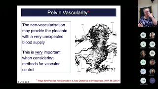 Oxford University surgical lectures: Integrated management of placenta accreta spectrum