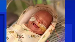 Nemours hospital helps Orlando baby born at 24 weeks beat the odds