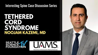 Interesting Case Discussion - Tethered Cord Syndrome - Noojan Kazemi, MD