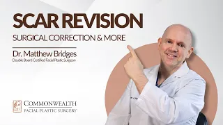 Scar Revision | Commonwealth Facial Plastic Surgery