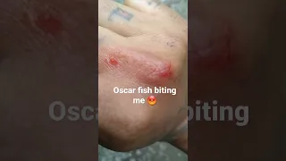 oscar fish biting me 😡