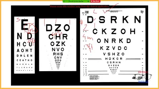 Visual Acuity Calculations in Low Vision in Urdu/Hindi