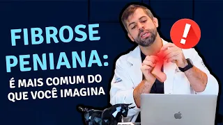 Fibrose Peniana  é Mais Comum do que Você Imagina! | Dr. Marco Túlio Cavalcanti - Andrologista