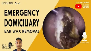 686 - Emergency Domiciliary Ear Wax Removal
