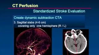 ISCT 2014: Brain Perfusion - Dr. Prokop