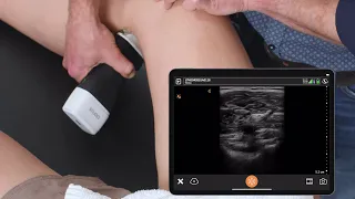 Deep Vein Thrombosis (DVT) - Ultrasound Scanning Technique