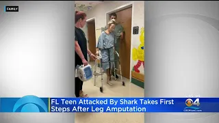 Teen Shark Attack Survivor Takes First Steps After Amputation