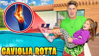 AURORA CADE E SI FA MALE E SI ROMPE LA GAMBA MENTRE GIOCA A NASCONDINO CON PAPÀ MIKE E LAURA! PIANGE