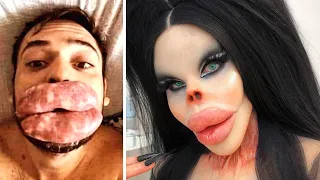 10 Bizarre People Who Took Plastic Surgery Too Far