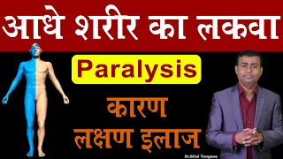 आधे शरीर का लकवा Paralysis कारण लक्षण इलाज।