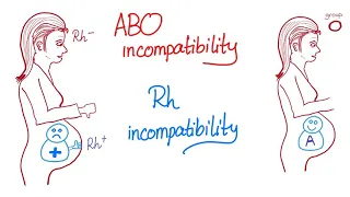 ABO incompatibility vs. Rh incompatibility