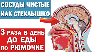 Чистка сосудов от холестерина и от тромбов в домашних условиях народными средствами без лекарств