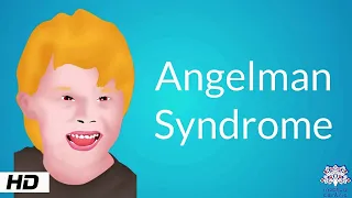 Angelman Syndrome, Causes, Signs and Symptoms, Diagnosis and Treatment.