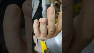 Отрезало палец