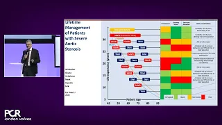 Create the future of TAVI - Optimisation of the procedure & patient pathway - PCR London Valves 2022