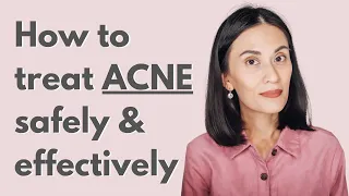 Safe and Effective Treatment for Mild to Moderate Acne | Dr Gaile Robredo-Vitas