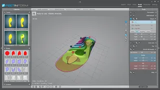 5.5.4 FIF – 3D-Werkzeuge für die Konstruktion einer individuellen orthopädischen Einlage