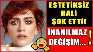 Mucize Doktor Beliz'İ Hazal Türesan'ın Estetiksiz Hali Şok etti! Gören Tanıyamadı