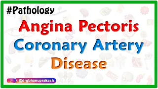 Diagnosis of Angina Pectoris as per latest Guidelines : USMLE Step 1 coronary artery disease