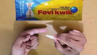 How To Remove Feviquick From Hands