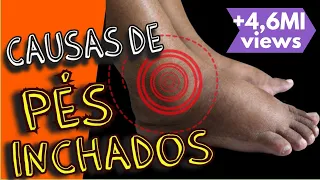 PÉS INCHADOS: causas e tratamentos de inchaço nos pés e pernas (e como desinchar)