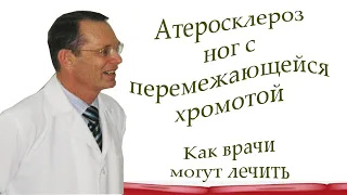 Атеросклероз ног с перемежающейся хромотой.Как врачи могут лечить.Видеобеседа для ВСЕХ и для врачей.