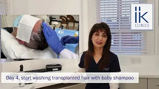 FUE hair transplant- How to wash your hair after a hair transplant | Dr Irum Khan