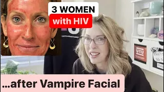 Vampire Facials Transmit HIV to 3 Women