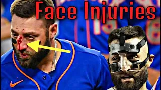 MLB Serious Face Injuries