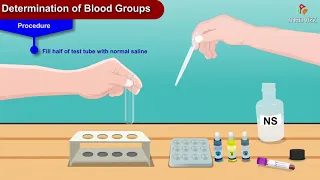 Determination of blood groups animation -  Physiology practical's