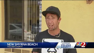 'Like a crunch': Surfer bitten in the face by shark at New Smyrna Beach speaks out