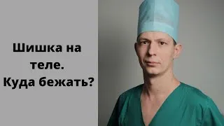 Шишка или опухоль на теле или под кожей. Что делать? Куда обращаться?