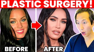 Plastic Surgeon Reacts to MEGAN FOX Cosmetic Surgery Transformation!