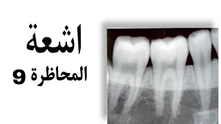 اشعة panoramic radiography مرحلة ثالثة طب الأسنان #radiology