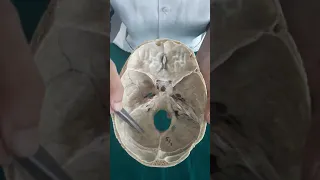 interior of Skull - Attachment of Cranial Fossa ( Neuroanatomy )