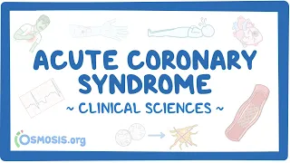 Acute coronary syndrome: Clinical sciences