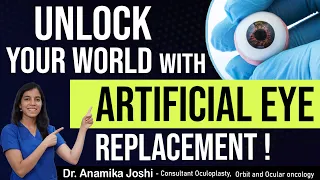 What is artificial eye replacement surgery | artificial eye | Dr Anamika Joshi
