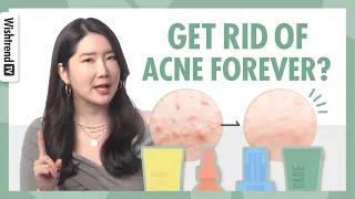 Get Rid of Acne Skincare Routine | TOP 5 most effective ingredients for Acne Treatment