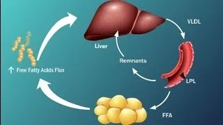 Fatty Acids and Disease in Type 2 Diabetes