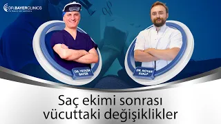 Saç Ekimi Sonrası Komplikasyonlar ve Vücuttaki Değişiklikler  |  Dr. Bayer Clinics