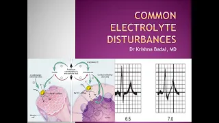 Common electrolyte disorders in Children